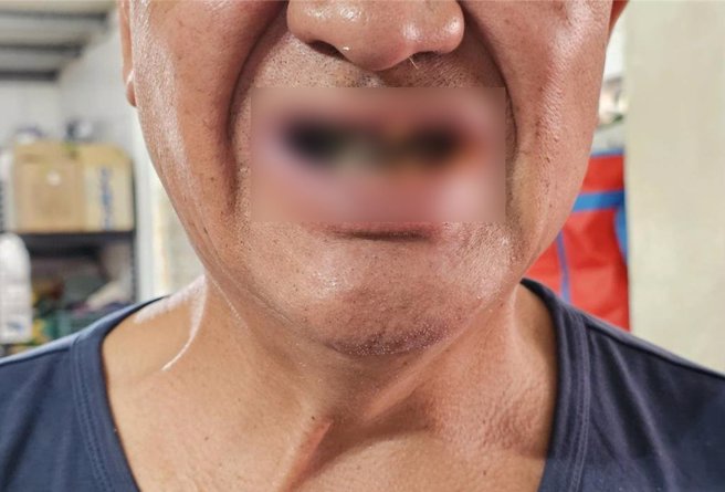 偏鄉醫療資源缺乏，長輩牙齒無法獲得妥善照顧。（范織欽服務處提供）