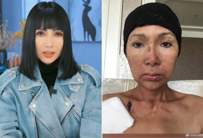 大陸女星張咪宣布罹患舌癌。（圖／翻攝自微博）