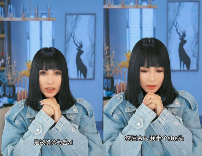 張咪透露，即將切除半邊舌頭，日後恐怕不能再唱歌。（圖／翻攝自微博）