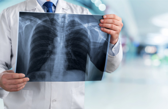 AI助攻！高雄医大携手彰基 预测肺阻塞恶化风险