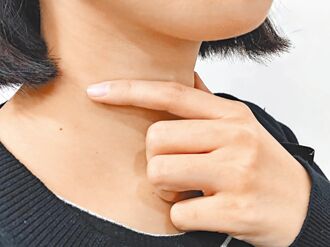 食道癌前病變 微創手術免開胸