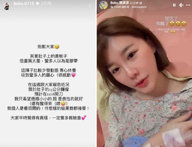 陈波波因检查发现肚中长13公分肿瘤，提醒粉丝要注意身体健康，术后也跟粉丝报平安。（图／翻摄自陈波波IG、脸书）