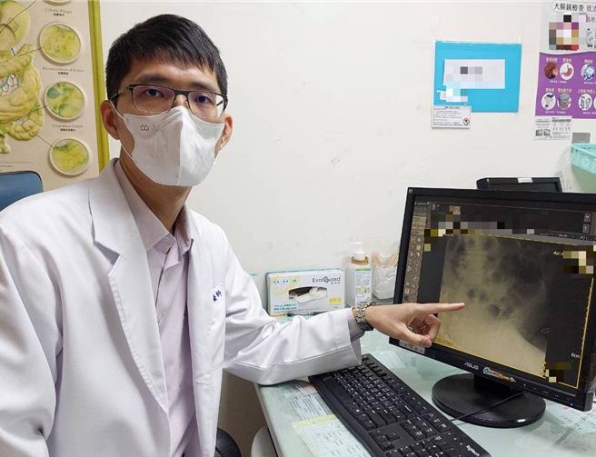 苗栗县大千综合医院肝胆肠胃科医师林德福建议，当恶性肿瘤造成肠阻塞，若考量手术风险，也可考虑使用大肠支架置放术。（大千医院提供／谢明俊苗栗传真）