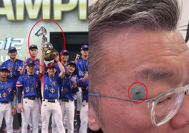 中华职棒会长蔡其昌在网路PO出被冠军奖杯砸伤的伤口。（图／中时资料照／翻摄tsaimimi0416）
