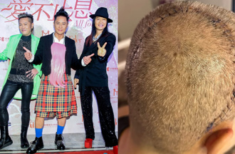 57歲蔡一傑切腦瘤「頭留蜈蚣疤」休養滿月 草蜢隊友鬆口他近況