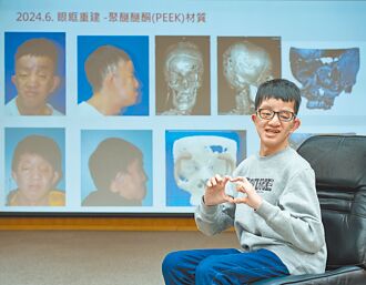 臉縮眼凸被笑外星人 20次手術重生