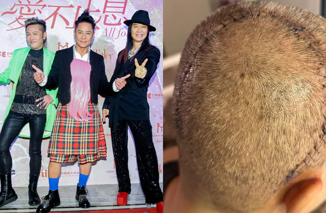 草蜢团员蔡一杰上个月证实动刀切除脑瘤，外界都很关心他的復原状况。（图／中时资料照、翻摄自蔡一杰Instagram）