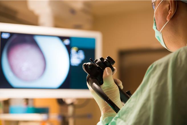 國健署明年將試辦無痛大腸鏡檢測。（本報資料照）