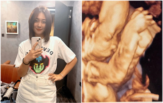 33歲張文綺突曬超音波照「謝謝小天使來到」 孩子爸身分曝