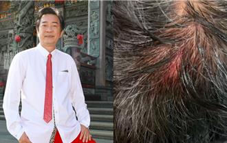 68歲八點檔男星逛賣場爆意外 「頭破血流」昏倒在地