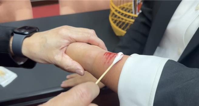 民進黨立委王美惠手腕甚至因此擦傷濺血。（林楚茵辦公室提供／游念育台北傳真）