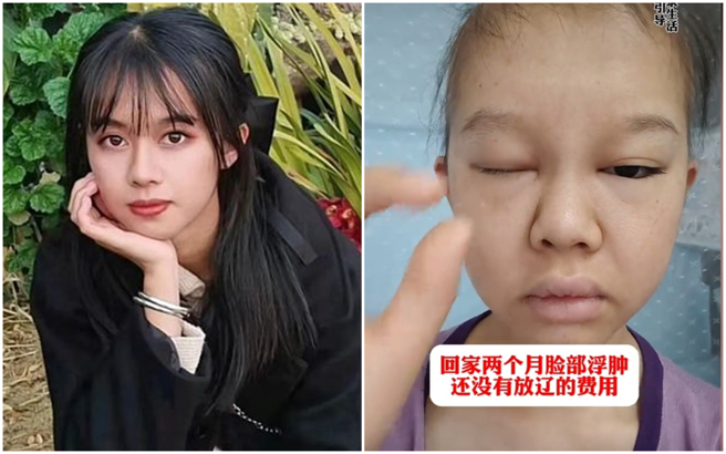 大陆抗癌网红卜娜娜不敌病魔离世，享年25岁。（图／摄自卜娜娜抖音）