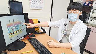 清創植皮救傷口 加速癒合