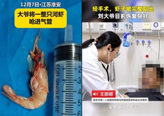 吃飯不專心！陸大爺邊吃邊回話 竟整隻蝦卡氣管「險喪命」