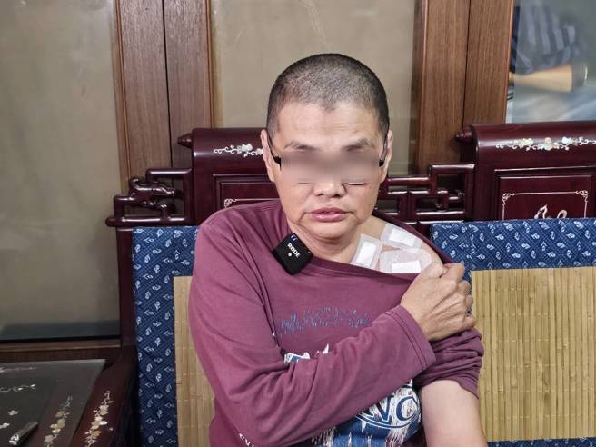 60岁清寒妇人阿娇去年严重车祸，导致她锁骨骨折、脑震盪等。（记者游定刚拍摄）