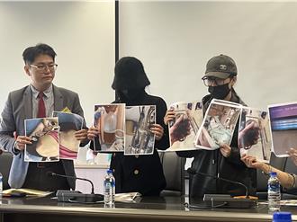 隆乳後急性腎衰竭！ 2女控醫美診所麻醉藥有問題