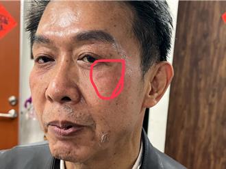 控邱镇军巴许智杰头 黄捷批流氓行径：要打死人吗？