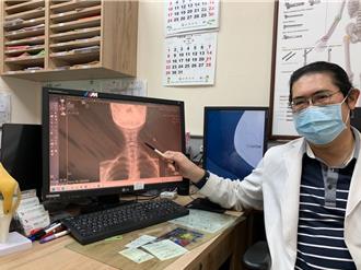 婦頸椎術後仍「僵硬痠麻」 竟是慢性肌筋膜炎作祟