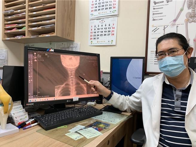 活力得中山脊椎外科医院骨科医师王振华指出，颈椎术后却仍僵硬酸麻，当心慢性肌筋膜炎所致。（活力得中山脊椎外科医院提供／纪爰高雄传真）