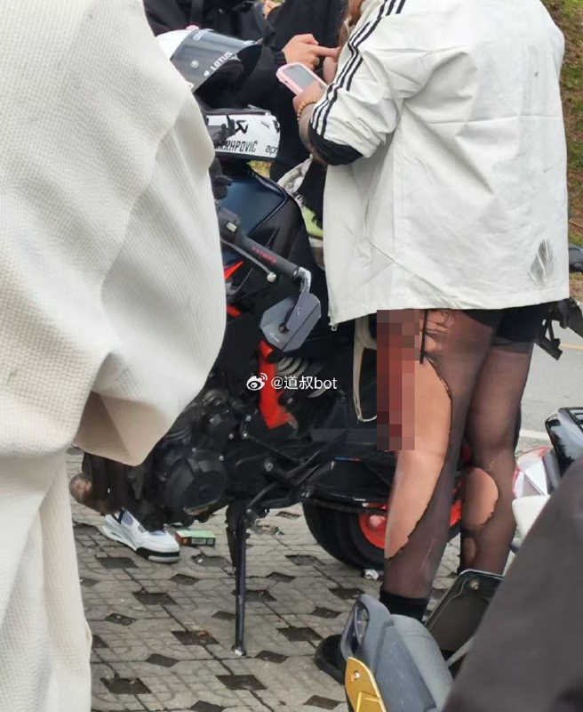 重机女子的丝袜直接被磨破，蜜大腿还出现大面积破皮。（翻摄自微博）