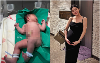 無名美女小予生了！辛苦吃全餐還發燒抱不到兒