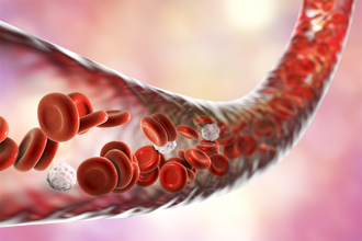 男頸動脈長斑塊 改吃1食材搭配藥物 半年逆轉病情