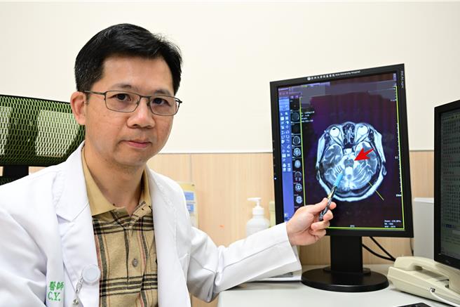 亚洲大学附属医院神经内科主任吴致萤指出，多发性系统萎缩症是相对罕见的原发性脑部退化疾病，会有记忆力不佳、帕金森症状及明显自律神经失常等，其盛行率仅约莫10万分之2至5间。（亚大医院提供／潘虹恩台中传真）