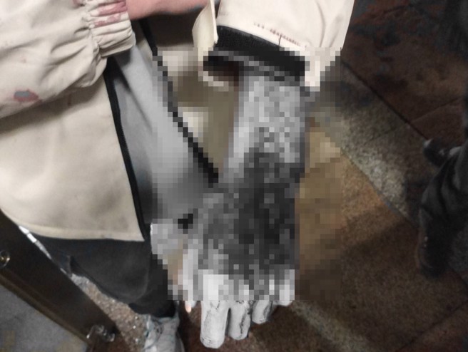 卓男持菜刀砍人反遭划伤，刘男也被菜刀砍受伤。（翻摄画面）