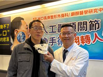 車禍臉變形「嘴巴張不開」 34歲男無法進食 靠1手術恢復