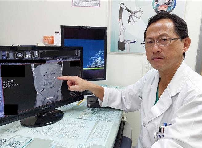 苗栗县大千医院外科部主任冯启彦提醒，若出现大肠癌症状，无论年纪大小，务必及早就医。（大千医院提供／谢明俊苗栗传真）