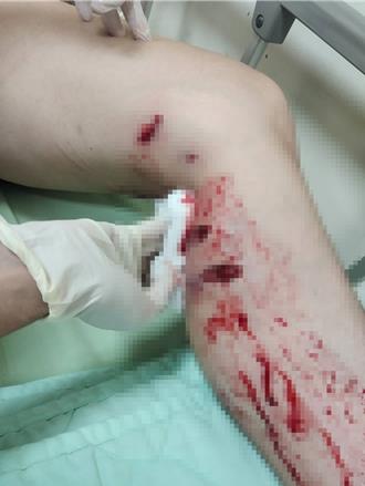 遭租車行狗咬傷！飼主竟無罪 二審法官逆轉判過失傷害