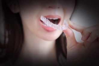 國人瘋戴隱形牙套引發亂象  衛福部：勿使用未經核准牙套