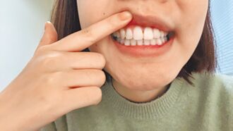 忽视牙周病 50万人恐全口无牙