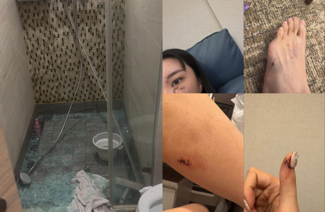 璇璇脸部、手、脚多处缝针。（图／threads@璇璇）