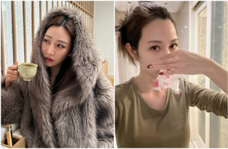 曾莞婷因1事爆鼻血！竟看《影后》学会正确止血术：别往后仰