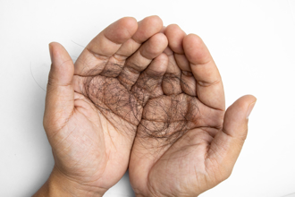 乾毛巾搓湿髮伤害大 3原因让头髮一直掉 