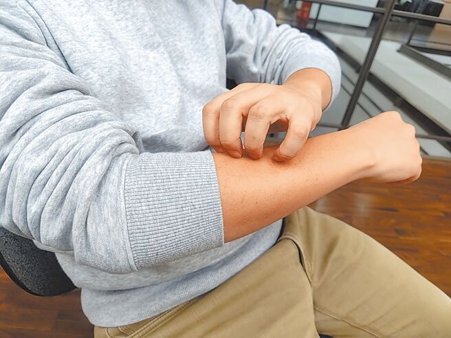 慢性搔癢是指持續6周以上的搔癢，每5人就可能有1人遭受這種困擾，且年齡越大盛行率越高。（王家瑜攝）