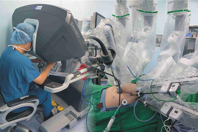 张先生确诊为大肠癌第三期且已扩散至肝，以双达文西手术同时进行直肠及肝臟的肿瘤切除。（示意图，彰基医院提供／叶静美彰化传真）