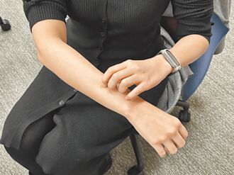 醫揭「史迪爾氏症」高燒、皮疹3警訊 恐引發免疫風暴致命