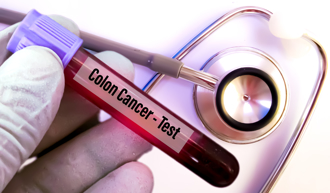 沒壞習慣生活正常還罹癌 科學家曝潛在元凶