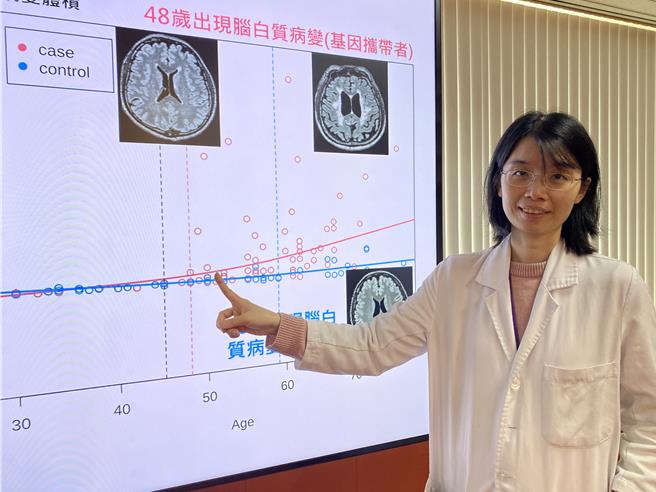 中榮神經內科醫師董欣指出，中榮研究發現，R544C帶因者從48歲開始，腦部白質病變風險就會快速增加。（台中榮總提供／馮惠宜台中傳真）