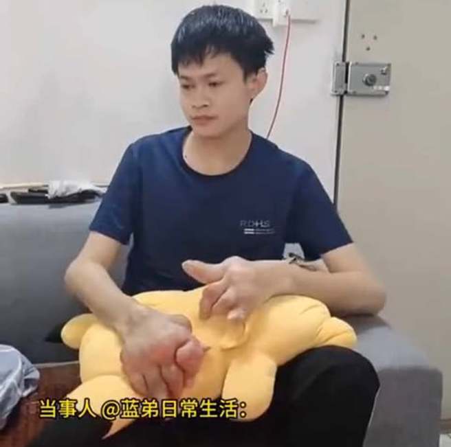 大陸廣東1名95後（1995年後出生）藍姓男子長期把汽水、奶茶當水喝，每天至少要喝3瓶以上的飲料，結果導致雙手長滿痛風結石。（圖 / 擷取自微博）