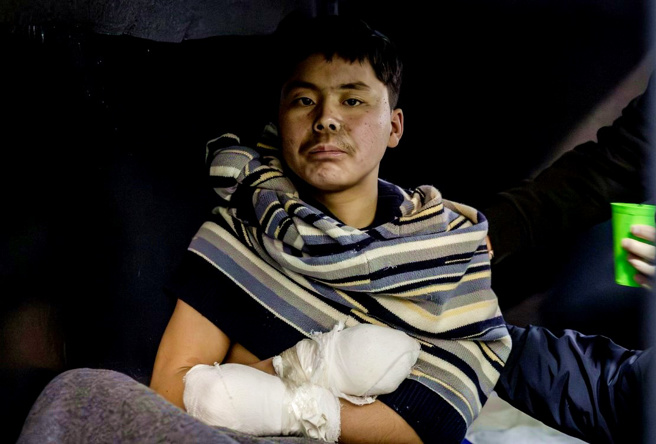 乌克兰总统泽伦斯基11日证实，首度在俄乌战争前线活捉2名北韩士兵。图为其中一名被俘北韩士兵。（图／撷取自泽伦斯基官方X）