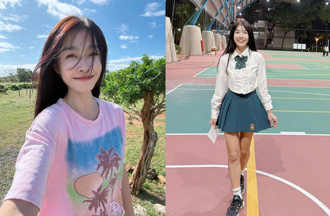 小嫻無畏寒流穿短袖！ 曝「慘跌破相」傷疤網心疼 