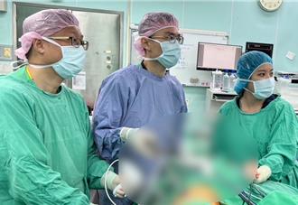 婦不菸不酒罹食道癌 大腸替代胃重建免除化療之苦