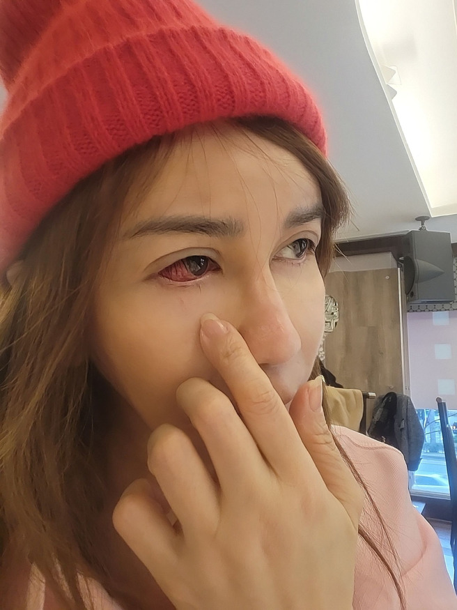 王瀞文换过多位医生才检查出病因。（图／王瀞文脸书）