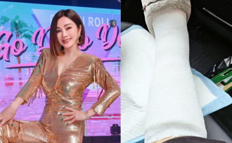 陳美鳳糟了！邊走邊滑手機「慘摔骨裂」 打石膏坐輪椅過年