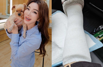 陳美鳳「慘摔骨裂」昔肩膀重創！ 樂觀報平安：骨頭沒斷好加在