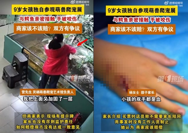 9岁女童参观爬宠展，竟伸手去逗鱷鱼遭咬伤，家长怒求偿，与商家没有达成共识。（翻摄微博）