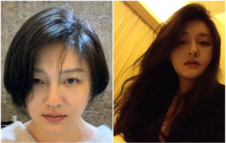 大S心臟二尖瓣脫垂 曾為產子癲癇發作「失去呼吸」險喪命 